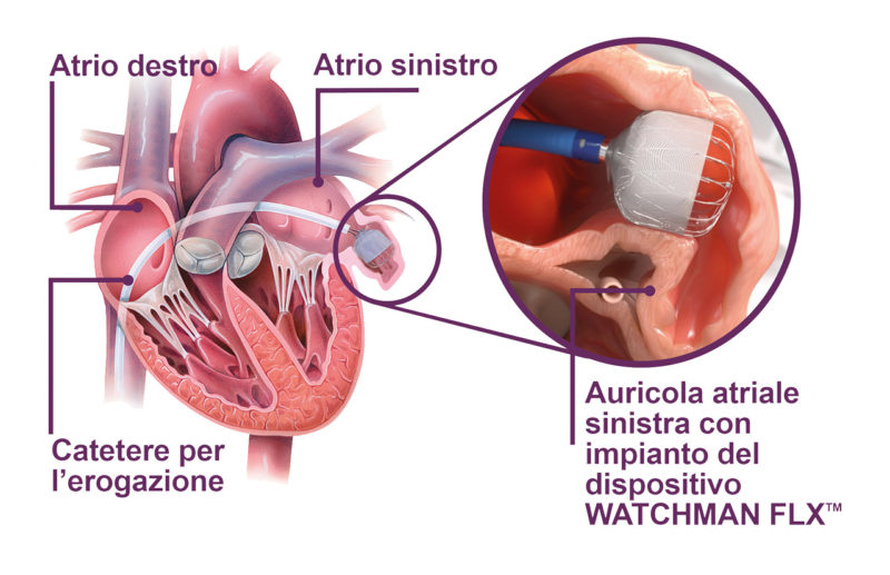 CHIUSURA-AURICOLA-def